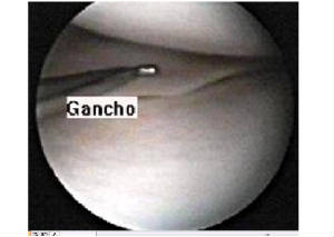 gancho.jpg
