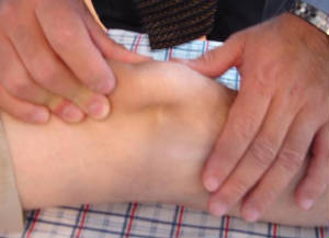 rodilla.jpg